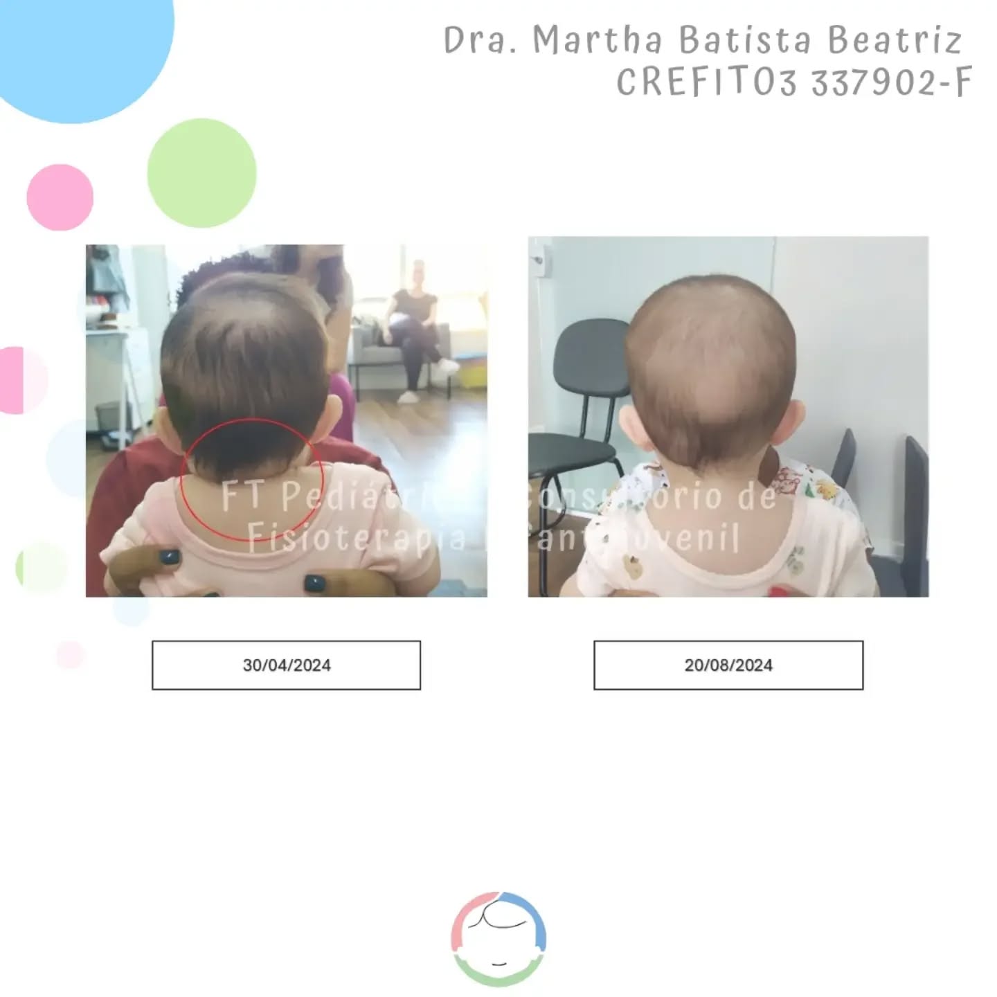 Seguimos entregando resultados 😍
@fisiomartha_bbeatriz
Método De Setti (em formação)
@carolinadesetti