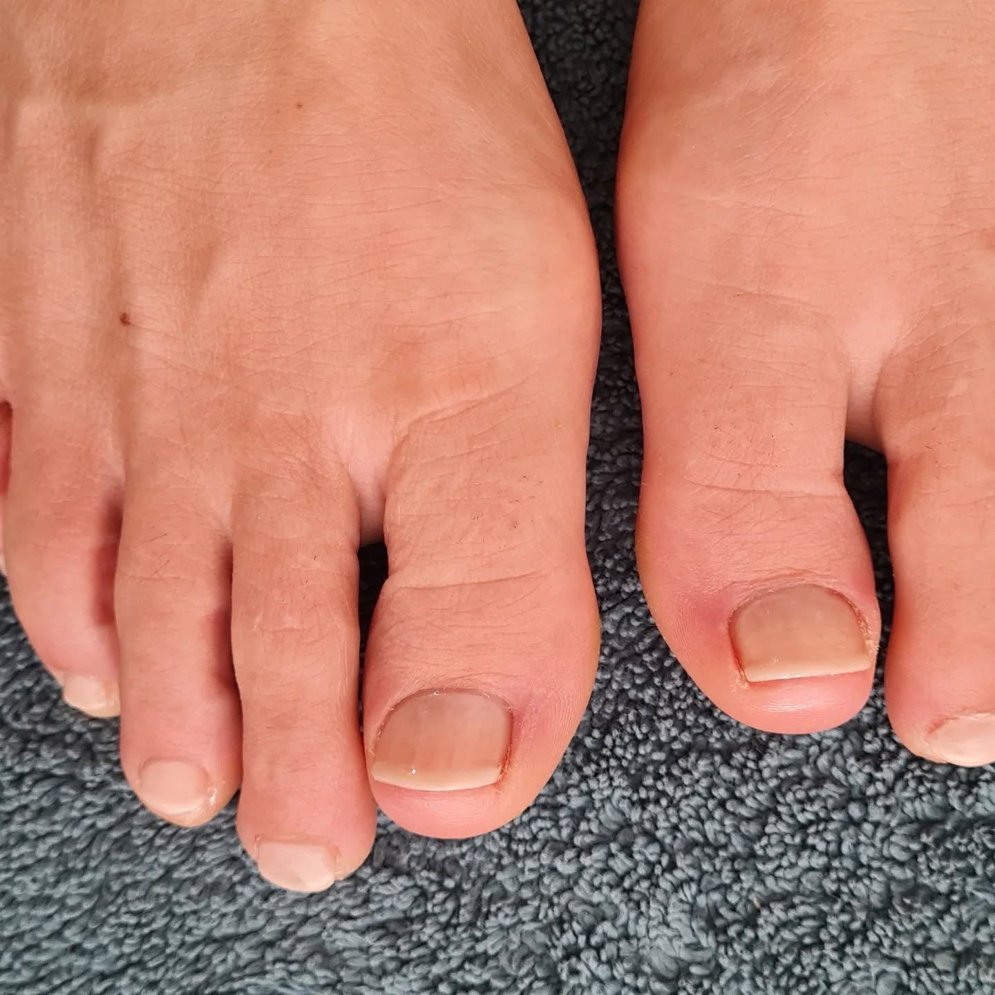 Natural French on Toes #Pedicure #Frenchpolish