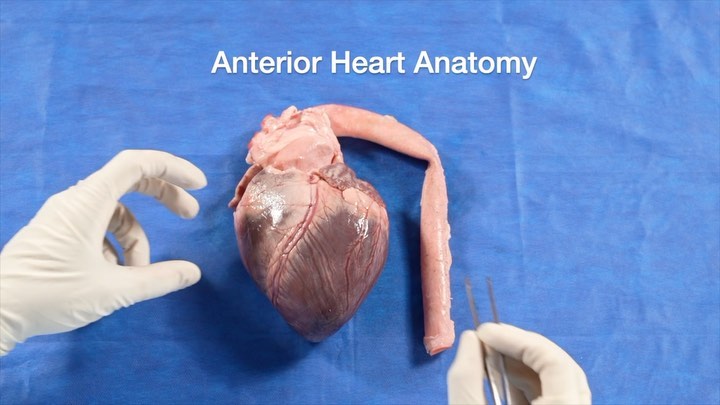 The Anatomy of the Heart - Educational Healthcare Video.
Shown here is a Clip from a Medical Video filmed by The Vision Field for a leading educational institution 🥼 in The Medical Field ..
..
..
#anatomyheart #medicalvideo #heart #educational #medicaleducation #health #medical #educator #anatomy #medicalfield #healthcare #medicalvideos #medicalschool #losangelesvideoproduction