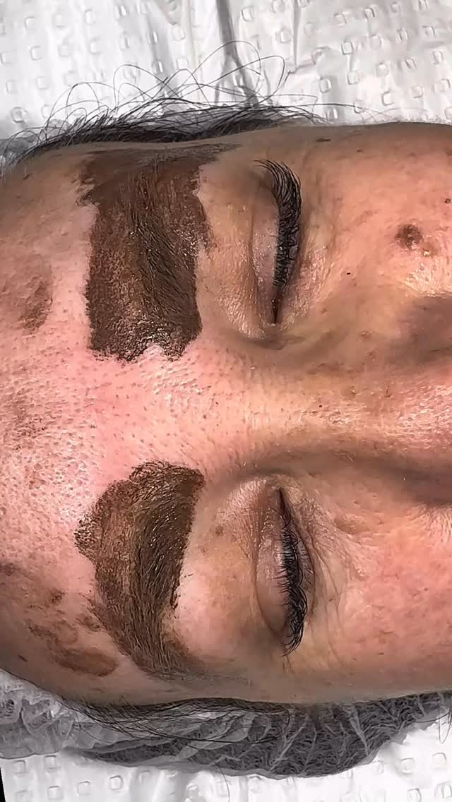 👀Behind the crazy pigment soak….. you’ll see each hair stroke is hand-crafted to look like real hair for the most natural brow tattoo you’ve ever seen ✨
That’s the power of HairStroke Hyperrealism tattooing — each line placed with surgical precision to mimic a real hair for a soft, realistic finish.
📍Smooth Beauty Bondi
✍️ Master Artist Shireen
💌 DM “BROWS” to book your transformation today
#HairStrokeBrows #FeatherTouchBrows #CosmeticTattooSydney #BrowTattoo #BrowTransformation #SmoothBeautyBondi #NaturalBrowLook #HyperRealBrows #WakeUpFlawless #BrowGoals #BondiBeauty #pmu #masterbrowartist