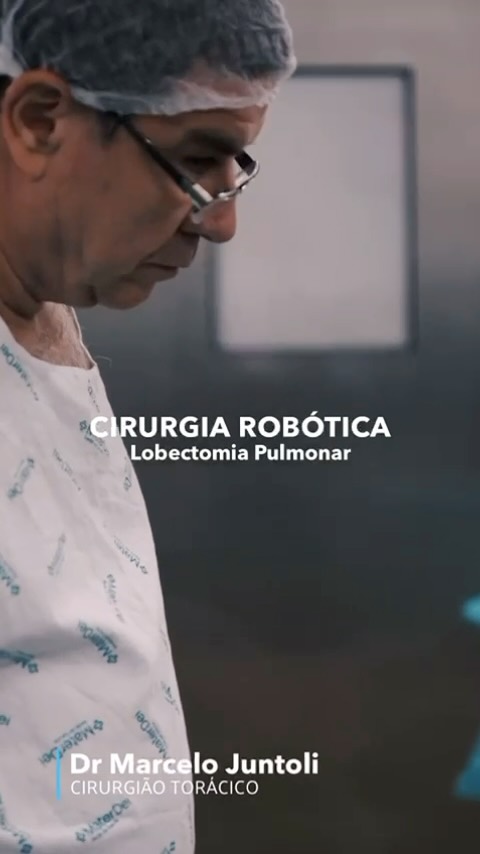Nos últimos dias, o Dr. Marcelo Juntoli, cirurgião torácico, realizou uma lobectomia pulmonar robótica, um procedimento de alta tecnologia que garante mais precisão, menos invasividade e uma recuperação mais rápida para o paciente.
A cirurgia robótica permite movimentos mais delicados e seguros, reduzindo sangramentos e riscos, além de proporcionar um pós-operatório mais confortável.
? A tecnologia está revolucionando a medicina, trazendo mais qualidade e segurança para os tratamentos cirúrgicos!