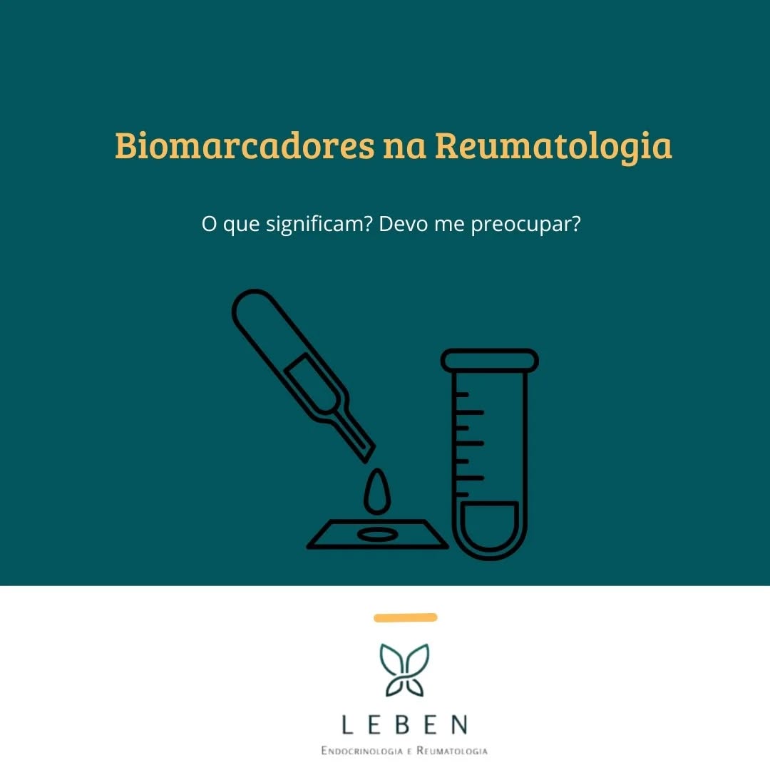 Biomarcadores em Reumatologia
Os biomarcadores são ferramentas essenciais no diagnóstico, prognóstico e monitoramento de doenças reumáticas. Eles incluem anticorpos, proteínas inflamatórias e outros marcadores laboratoriais que ajudam a identificar condições como artrite reumatoide (AR), lúpus e espondiloartrites.
1. Fator Reumatoide (FR)
- Positivo: Associado principalmente à artrite reumatoide (AR), mas também pode estar presente em outras doenças autoimunes (ex.: lúpus, síndrome de Sjögren) ou infecções crônicas. Em idosos saudáveis, um resultado positivo pode ser um falso positivo sem relevância clínica.
- Negativo: Não exclui a possibilidade de AR, pois cerca de 30% dos pacientes com AR são soronegativos.
2. Anti-CCP (Anticorpos Anti-Peptídeos Citrulinados)
- Positivo: Altamente específico para artrite reumatoide (especificidade de 95-98%) e indica maior risco de progressão para lesões articulares graves.
- Negativo: Não descarta AR, mas reduz a probabilidade.
3. VHS e Proteína C-Reativa (PCR)
- Elevados: Indicam inflamação sistêmica, comum em doenças como artrite reumatoide e espondiloartrites, e também em infecções agudas. Úteis para monitorar atividade da doença e resposta ao tratamento.
- Normais: Sugerem controle da inflamação, mas não descartam a presença de doenças inflamatórias.
4. Anticorpos Antinucleares (FAN)
- Positivo: Presente em doenças como lúpus eritematoso sistêmico (LES) e esclerose sistêmica. Requer confirmação com testes específicos (ex.: anti-dsDNA, anti-Sm) para definir o diagnóstico.
Pode ser positivo em pessoas saudáveis.
- Negativo: Reduz a probabilidade de LES, mas não a exclui completamente.
Interpretação dos Resultados
- Resultados Positivos: Nem sempre confirmam uma doença. Podem indicar predisposição genética, infecções ou outras condições. Exemplo: FR positivo em familiares de pacientes com AR sugere risco aumentado, mesmo sem sintomas.
- Resultados Negativos: Não descartam totalmente a doença, especialmente em fases iniciais. Exemplo: 20-30% dos pacientes com AR nunca desenvolvem FR ou anti-CCP.
ATENÇÃO: os biomarcadores são ferramentas complementares, não definitivas.