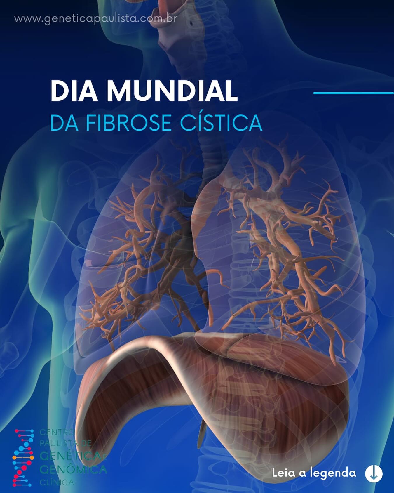 A Fibrose Cística é uma doença genética rara e crônica, causada por mutações no gene CFTR, que levam à produção de um muco espesso e viscoso. Esse muco compromete principalmente os pulmões e o sistema digestivo, provocando tosse crônica, infecções respiratórias recorrentes, dificuldade para respirar e má absorção de nutrientes.
🧬 Embora seja uma condição de manejo complexo, avanços como novas terapias moduladoras do CFTR, fisioterapia respiratória, uso contínuo de medicamentos e, em casos graves, o transplante pulmonar, têm aumentado a sobrevida e a qualidade de vida dos pacientes.
👉🏻 Além dos impactos físicos, a doença traz desafios emocionais e sociais, exigindo adesão rigorosa ao tratamento e acompanhamento multidisciplinar. O diagnóstico precoce e o acesso às terapias já disponíveis no SUS são fundamentais para que muitas pessoas com fibrose cística possam viver de forma produtiva e satisfatória.
Contem conosco!
🏥 @geneticapaulista
📌 Rua Dr. Nicolau de Sousa Queiros, 177 - Vila Mariana
São Paulo, SP
☎️ Telefone: (011) 3467-4625 e 99230-1219
📱 WhatsApp: (011) 98415-3780 e 99230-1219