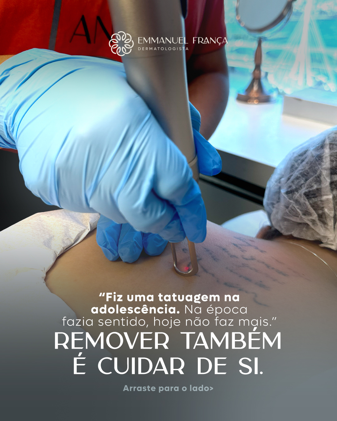 A remoção de tatuagens é uma forma de cuidar da sua identidade e autoestima. Com o uso de tecnologias avançadas, como o laser, é possível remover tatuagens de maneira segura e eficaz, proporcionando ótimos resultados sem agredir a pele.
Se você deseja transformar seu corpo e dar um novo significado ao que ficou para trás, agende sua consulta e descubra o melhor tratamento para o seu caso.
Dr. Emmanuel França
Dermatologista
CRM 5999 | RQE 636
📍Skin Prime – Riomar Trade Center – Torre 3 – Sala 1905
📱 (81) 97112-2323
#remocaodetatuagem #cuidadoscomapele #tratamentosdermatologicos #laser #dermatologia #rejuvenescimento #tatuagem #saudedapele #skinprime #DrEmmanuelFrança