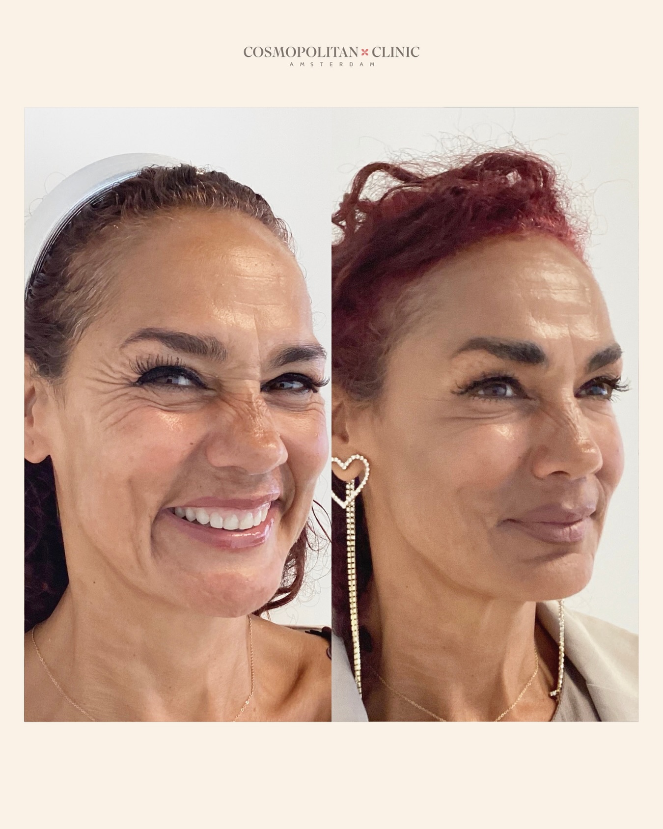 This smile is where we all do it for ??
#ʜᴀᴘᴘʏᴄᴜsᴛᴏᴍᴇʀ #womensupportingwomen #selflove