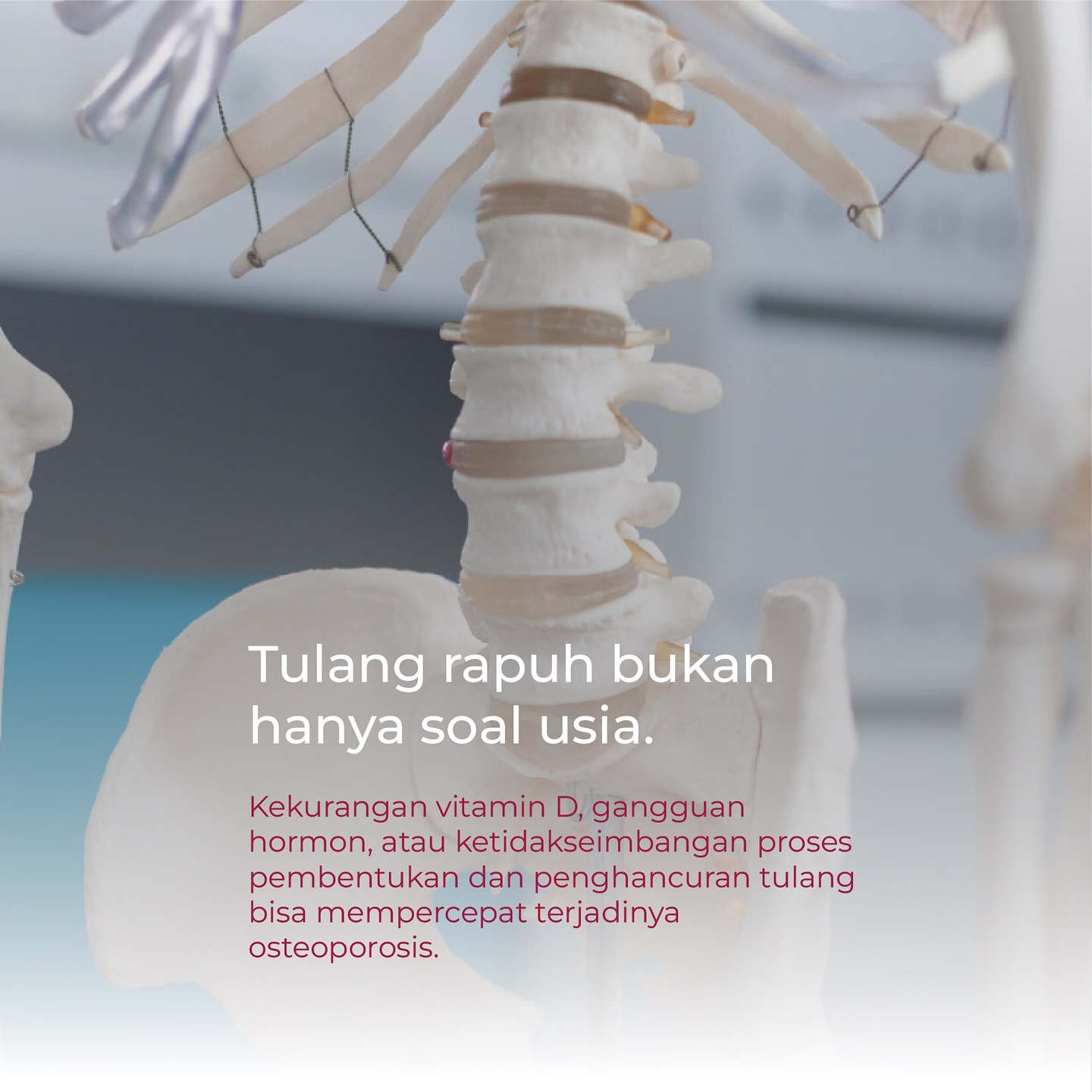 Jangan tunggu tua untuk peduli tulangmu. Kekurangan vitamin D, gangguan hormon, dan masalah metabolisme tulang bisa membuat tulang rapuh lebih cepat. Mulai jaga kesehatan tulang dari sekarang!