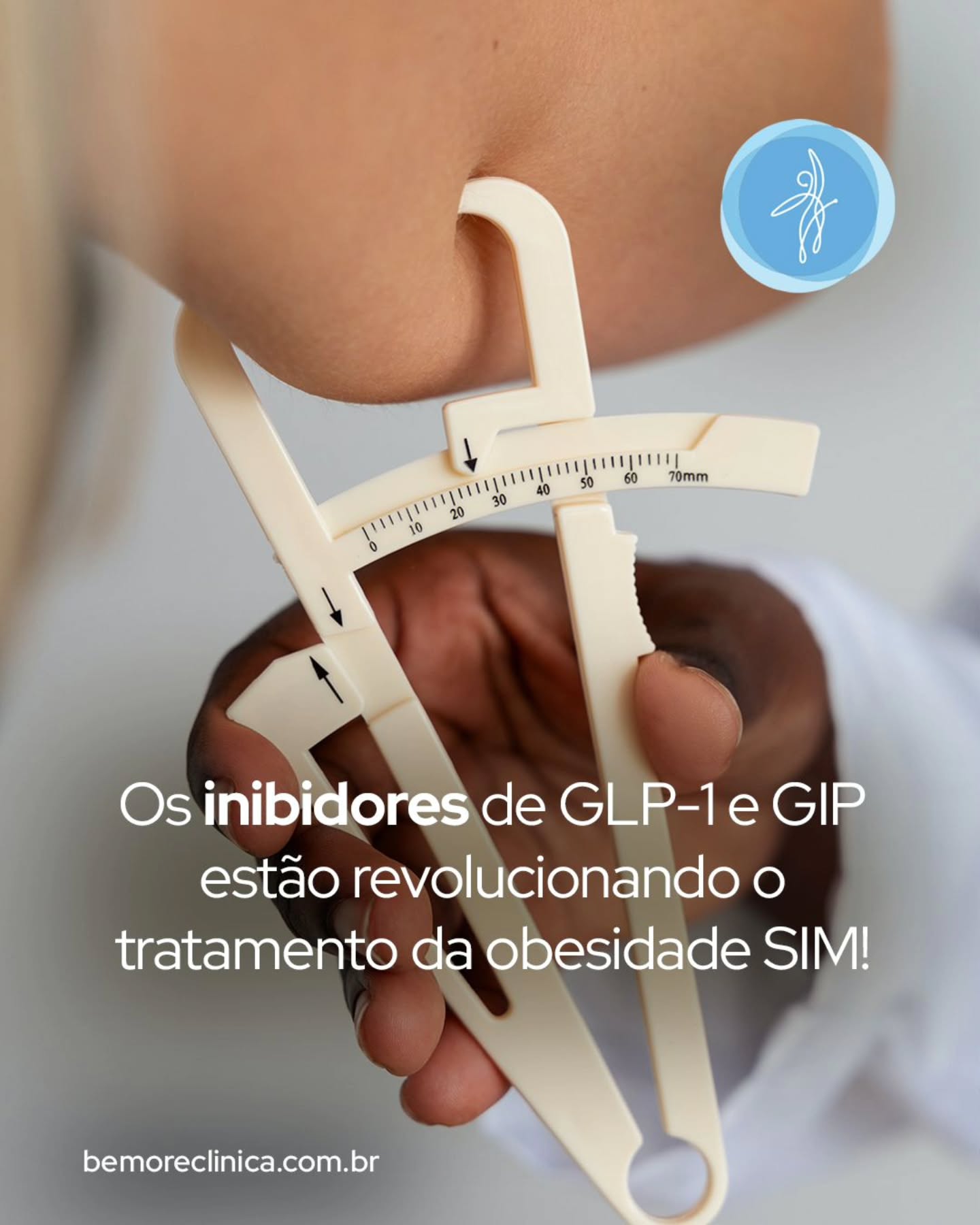 Semaglutida, tirzepatida, e em breve retratutida: os famosos inibidores análogos de GLP-1 e GIP, “as canetas emagrecedoras” que com certeza você já ouviu falar e conhece alguém que já usou. Sim, esses tratamentos estão revolucionando o tratamento da obesidade e trazendo muitos outros benefícios além da perda de peso.
Dada essa popularidade, nem tudo o que se fala por aí é verdade e é preciso lembrar que como todo tratamento médico precisa de avaliação, prescrição e acompanhamento, e que se automedicar é sempre um grande perigo. Mas também é verdade – e pode comemorar sim - essas medicações estão mudando o jogo da perda de peso, com estudos recentes apresentados no ObesityWeek 2025 destacando eficácia, adesão e segurança.
Mas vale saber: não é milagre, e sim uma ferramenta aliada a estilo de vida, metabolismo ativo e acompanhamento integrativo.
👉 Quer entender se essa ferramenta é para você?
Marque uma consulta em Campinas ou online.
#Semaglutida #EmagrecimentoSaudável #GLP1 #Metabologia #MedicinaIntegrativa #Longevidade