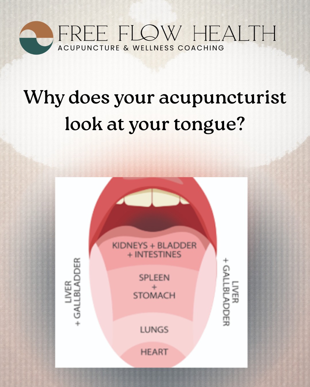 Your tongue is the only muscle in the body we can directly see — and in Traditional Chinese Medicine, it’s one of our most powerful diagnostic tools.
The color, shape, and coating of your tongue can reveal patterns related to:
• digestion
• circulation
• hormones
• stress & emotional health
• inflammation
• long-term energy balance
Unlike symptoms that can change day to day, the tongue reflects longer-term patterns happening beneath the surface. That’s why tongue diagnosis helps me personalize your acupuncture treatments instead of guessing or chasing symptoms.
Curious what your tongue might be saying about your health?
I just published a new blog explaining exactly how tongue diagnosis works and why it matters.
👉 Read it via the link in bio.
#AcupunctureSanDiego #SanDiegoWellness #SanDiegoTCM #SanDiegoAcupuncture #SanDiegoWomensHealth #SanDiegoHolisticHealth #SanDiegoHealth #SanDiegoHealing #SanDiegoSelfCare #SanDiegoMindBody