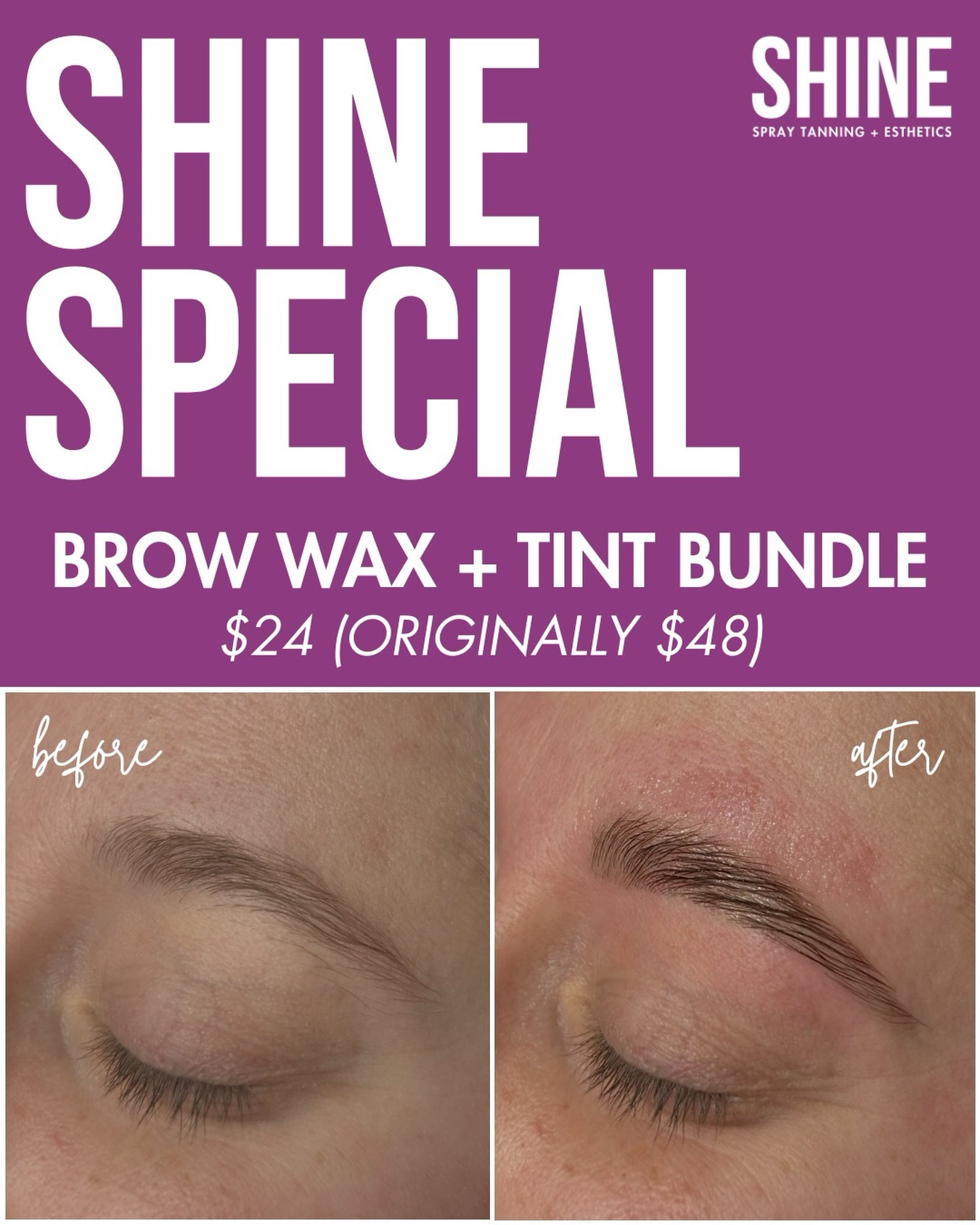SHINE SPECIAL ✨
Brows make a bigger difference than you think. A simple wax + tint can instantly define your face, enhance your natural shape, and cut down on daily makeup time.
Right now, our Brow Wax + Tint Bundle is just $24 (originally $48) - perfect if you want fuller-looking, polished brows without the hassle! 🤗
This is the final month to snag this deal and it ends at the end of December, so don’t wait. Appointments are limited so book now through the link in our bio or by calling one of our Shine studios 💜
#shinespraytanning #omahaesthetics #omahabrows #omahawaxing #waxandtintbrows