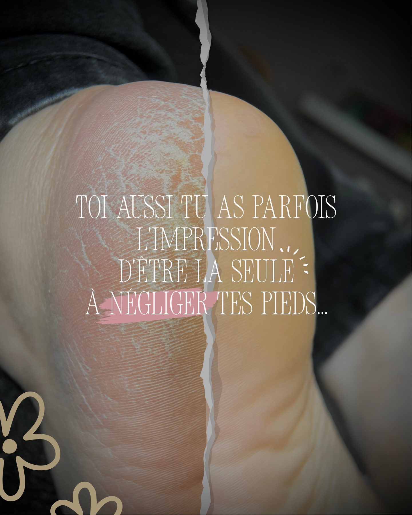 Si tu t’es reconnue en lisant ces lignes, ce n’est pas un hasard.
La majorité des femmes s’occupent de leurs pieds quand l’inconfort devient visible…
ou impossible à ignorer.
La réalité, c’est que la majorité des inconforts viennent de mois (parfois d’années) de négligence involontaire.
Oui, une séance change déjà beaucoup.
Et c’est souvent ce qui surprend le plus.
Mais le vrai confort, celui qui dure, se construit avec des soins réguliers, adaptés, respectueux.
Au Boudoir, je ne promets pas des pieds “parfaits” en une fois.
Je propose un vrai travail de fond pour des pieds sains, confortables et entretenus toute l’année
Le vrai changement, c’est quand le soin devient une habitude 🤎
Alors si ce post t’a parlé, prend ton rdv dès maintenant !
(Agenda en ligne dans la bio)
_____
Beauté des mains & des pieds
Manucure Russe
à 5 minutes de Sancerre
www.boudoirdescoquettes.fr