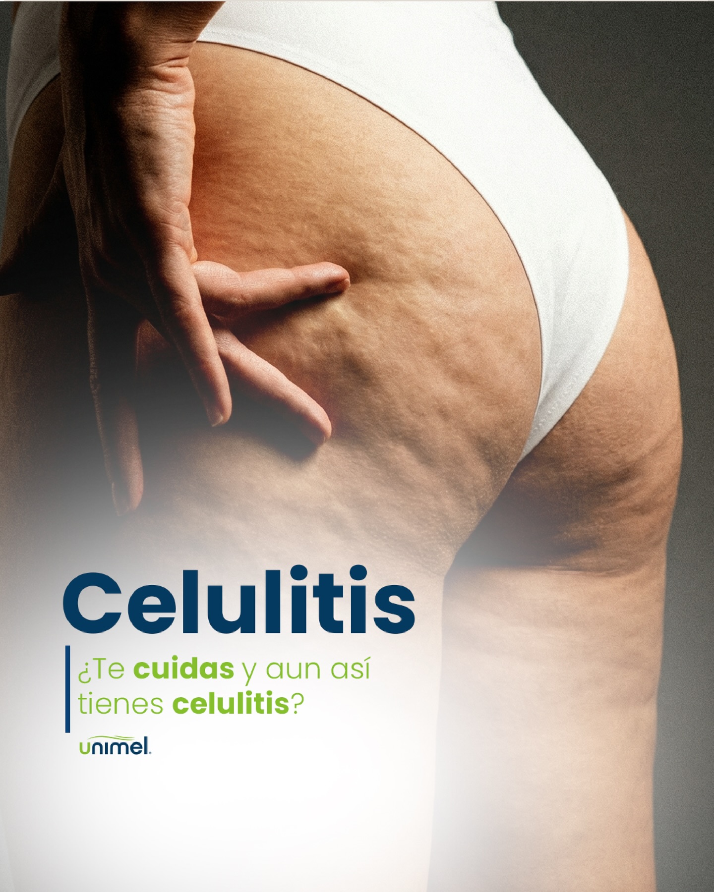 ¿Te cuidas, entrenas y aun así la celulitis sigue ahí? 💭
No es falta de esfuerzo ni disciplina. La celulitis no depende solo de la grasa; también influyen la retención de líquidos, la circulación y la calidad de la piel.
Por eso, muchas veces dieta y ejercicio no son suficientes… y entender esto cambia por completo la forma de tratarla.
Velashape es uno de los equipos más efectivos para mejorar la apariencia de la celulitis, alisar la piel y aliviar esa sensación de pesadez. ✨
Eso sí, los cambios reales vienen con constancia: sesiones progresivas, acompañamiento y cuidado continuo.
#Velashape #Celulitis #CuidadoCorporal #BienestarFemenino #MedicinaEstética Unimel Constancia