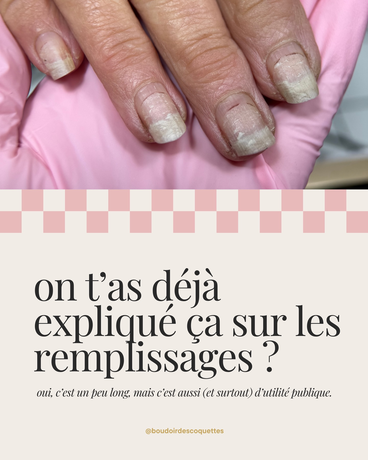 Un délai de remplissage n’est pas identique pour toutes.
Il dépend de tes ongles, ton quotidien, tes habitudes, de la longueur portée…
Et les ongles qui se décollent “toujours sur toi”,
ce n’est pas une fatalité.
Mais dépasser régulièrement ton délai de remplissage crée un déséquilibre.
Le décollement apparaît.
Ça s’accroche.
Ça s’arrache.
Et à force, la plaque s’affine.
Et une plaque trop fragilisée ne retient plus rien.
À ce moment-là, la seule solution, c’est de faire une pause.
Attendre 3 à 6 mois que l’ongle repousse sainement.
Parce que oui, mon travail, c’est la beauté.
Mais surtout, et avant tout, la santé de tes ongles.
Sans base saine, on peut camoufler…
Mais ça ne tiendra jamais durablement (et ça peut créer de vrais problèmes).
👉 Le maximum recommandé, c’est 4 semaines.
👉 Pour certaines, ce sera même 2 à 3 semaines.
Je comprends aussi qu’on adapte en fonction du budget.
Dans ce cas, on peut orienter vers des poses plus sécuritaires (longueur, forme, structure…).
L’objectif reste toujours le même :
Des ongles beaux, mais surtout solides et durables.
Si tu dépasses ton délai, tu prends un risque.
Anticipe. Réserve ton prochain rendez-vous maintenant.