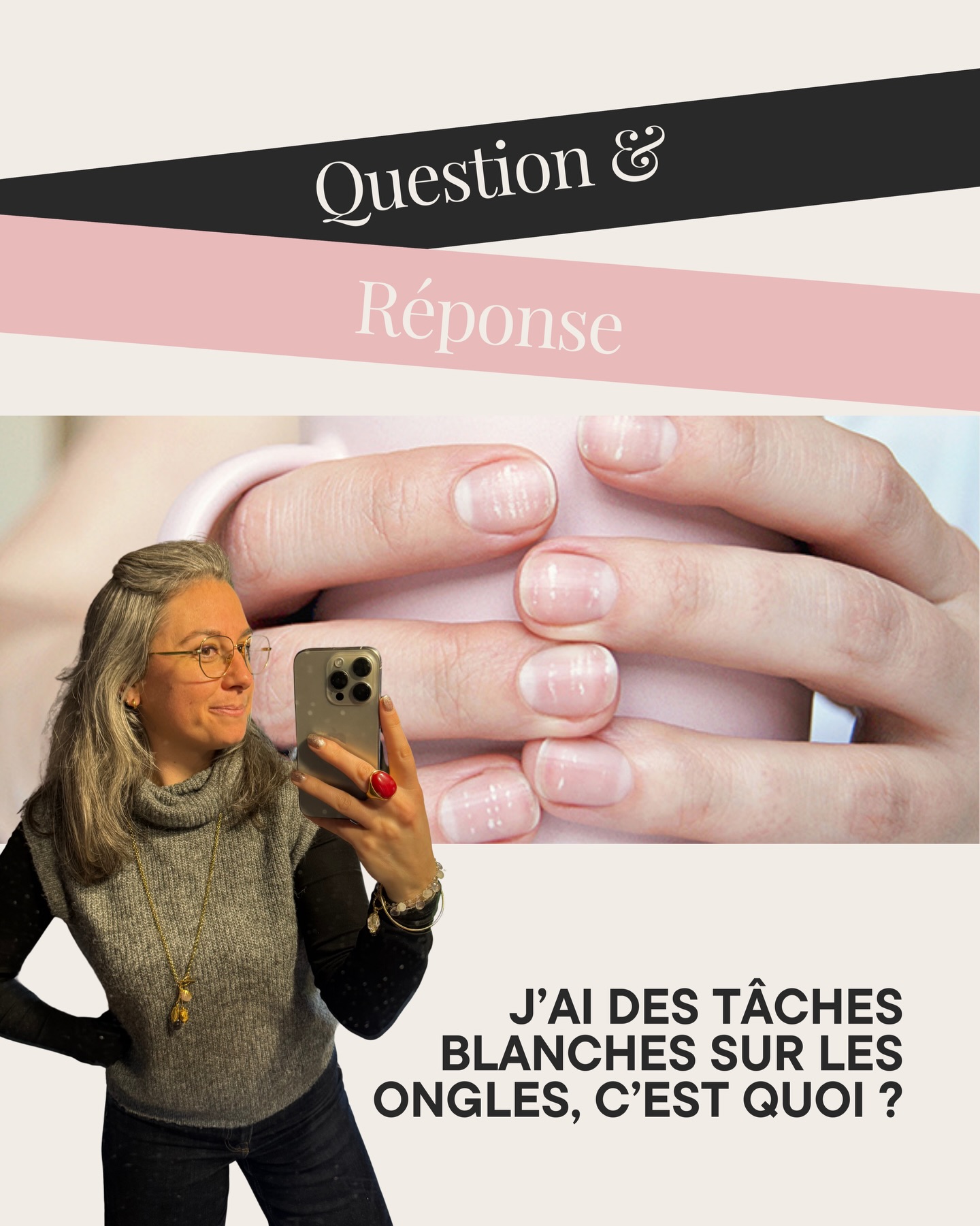 Eh non, ce n’est pas un manque de calcium ;)
Les taches blanches sur les ongles suscitent souvent des inquiétudes, et c’est compréhensible.
Dans la majorité des cas, il s’agit simplement de leuconychie : un phénomène courant, sans gravité, lié à la formation de l’ongle.
Après une dépose, elles peuvent sembler plus visibles parce que l’ongle est à nu,
mais elles n’apparaissent pas “à cause” de ce moment-là.
Observer, comprendre, respecter la plaque naturelle :
c’est souvent tout ce qu’il faut pour accompagner une repousse saine, sans sur-intervention.